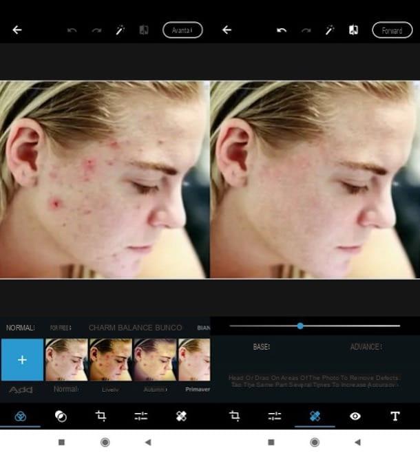 How to remove pimples from photos