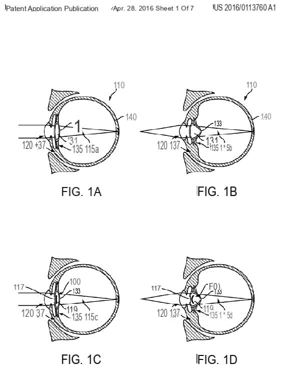 Google brevetta l'occhio bionico